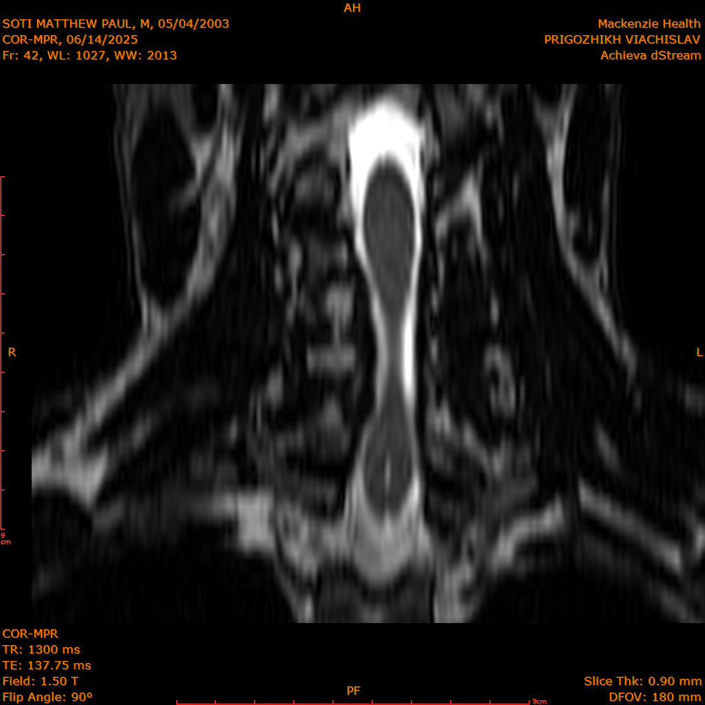 2025-06-14/COR-MPR/0043-IM128.png