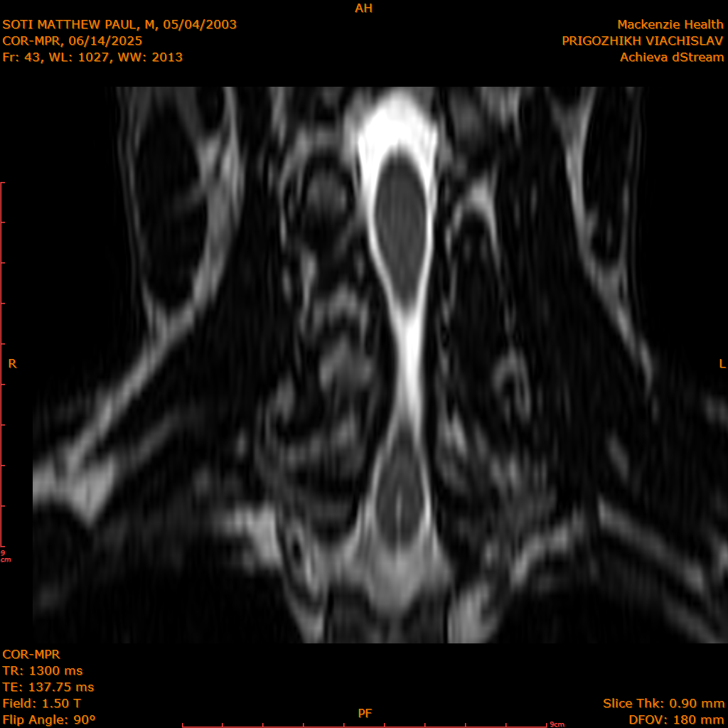 2025-06-14/COR-MPR/0044-IM129.png
