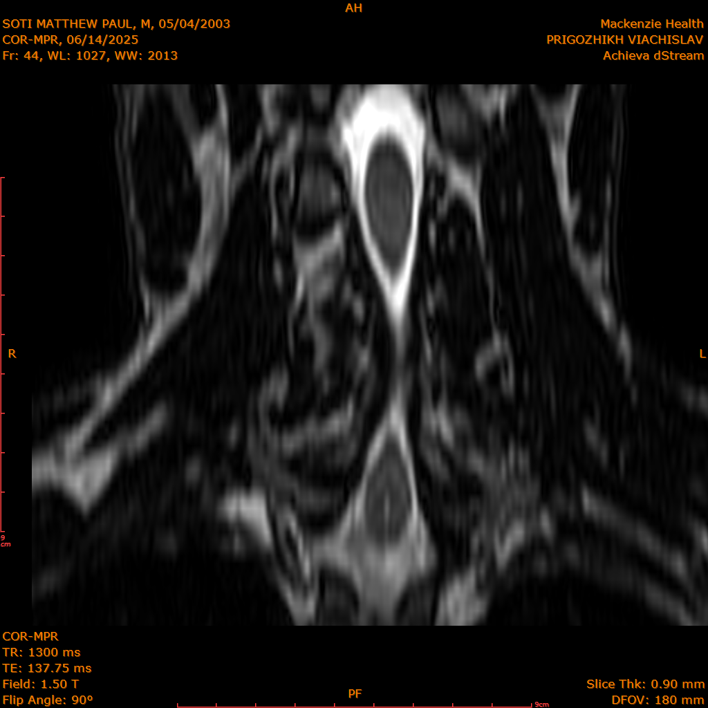 2025-06-14/COR-MPR/0045-IM130.png