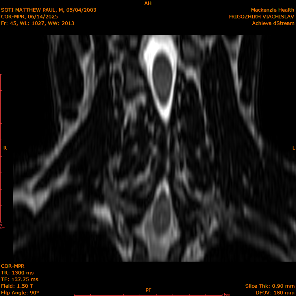 2025-06-14/COR-MPR/0046-IM131.png