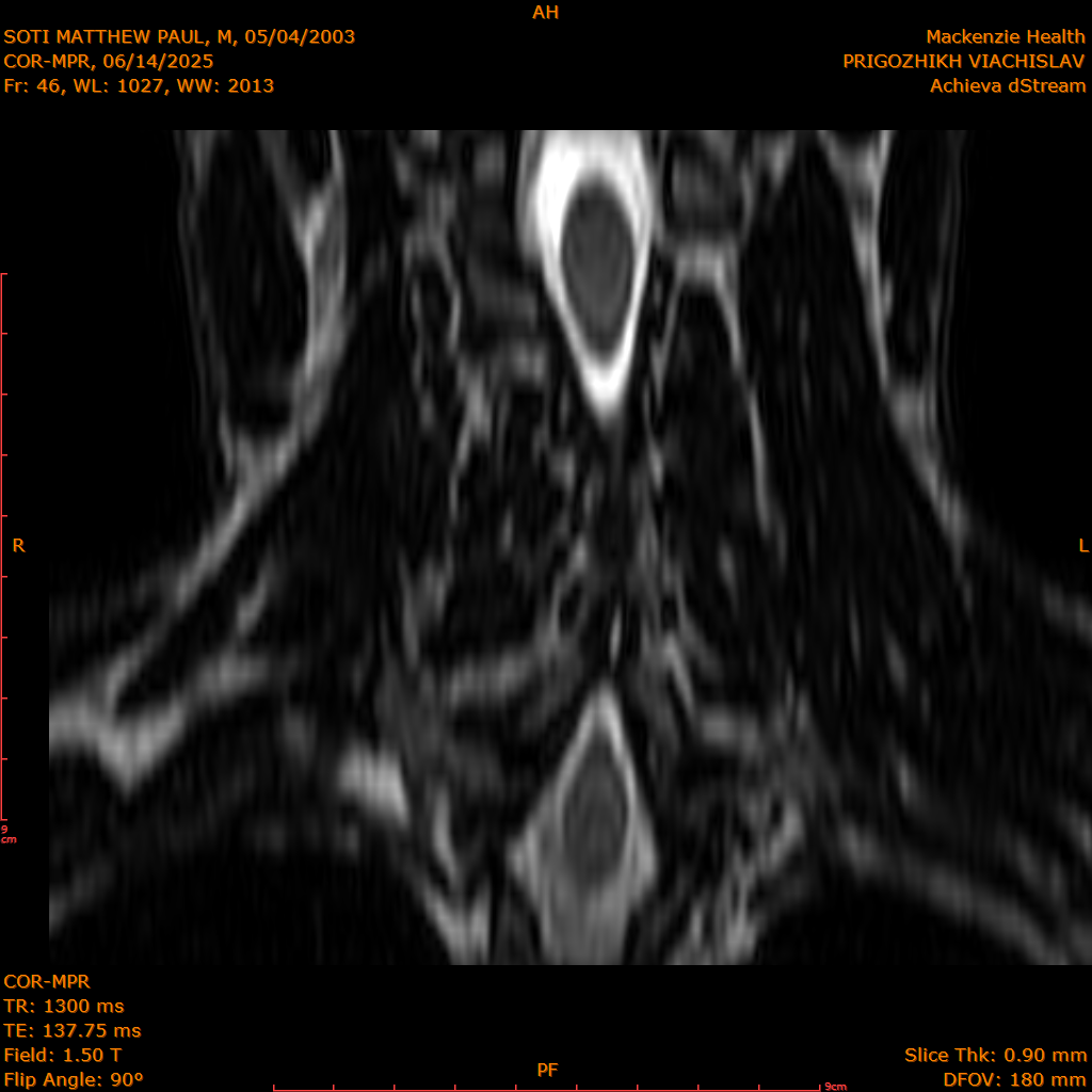 2025-06-14/COR-MPR/0047-IM132.png