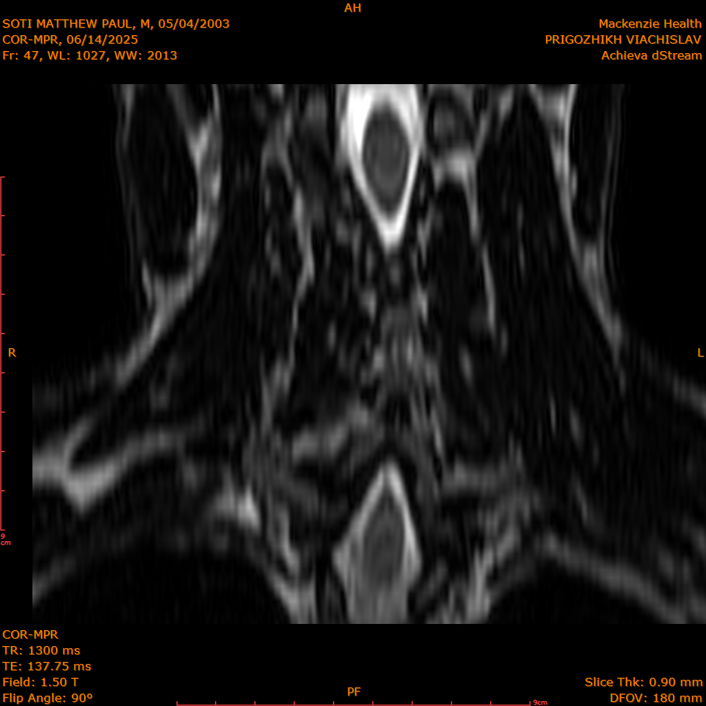 2025-06-14/COR-MPR/0048-IM133.png
