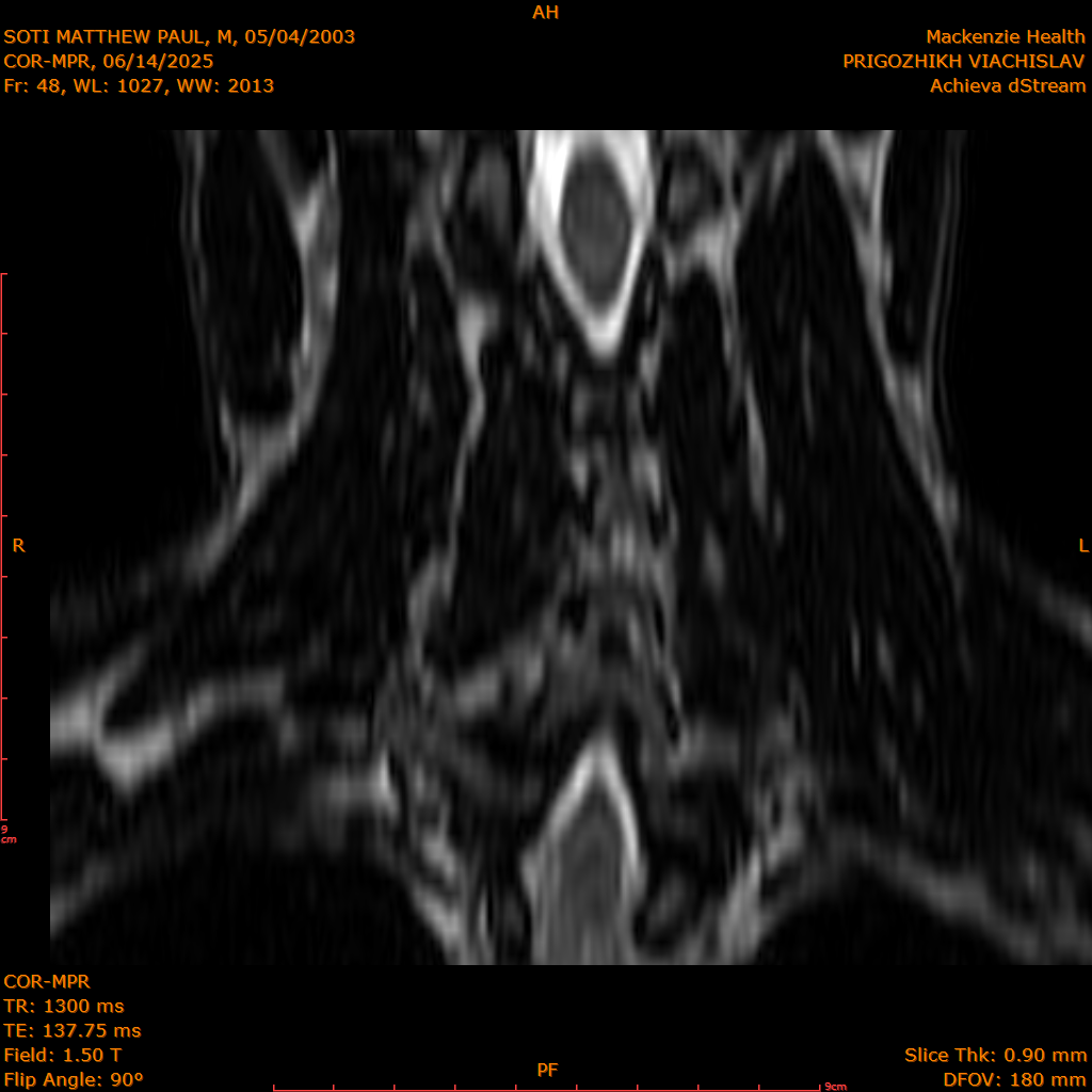 2025-06-14/COR-MPR/0049-IM134.png