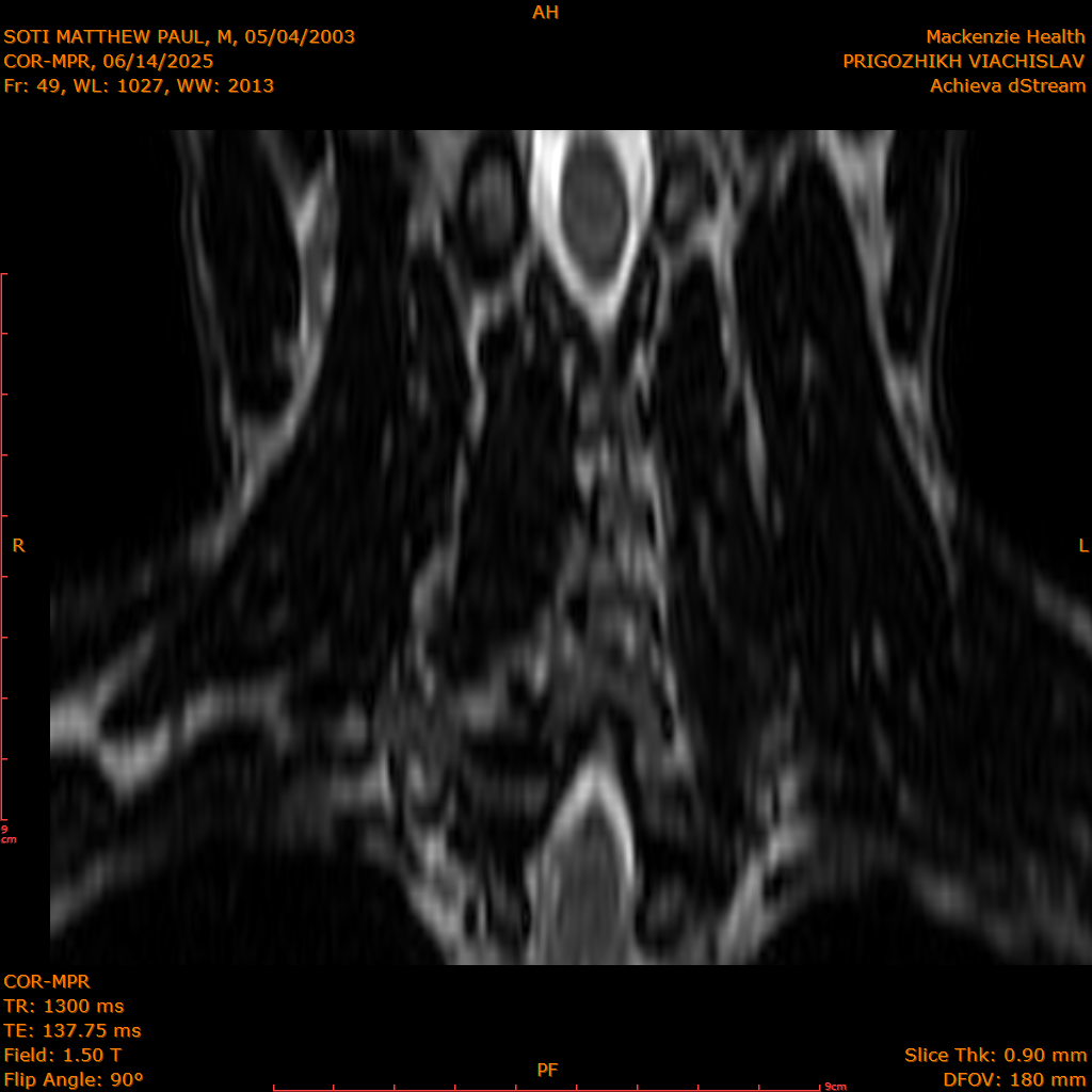 2025-06-14/COR-MPR/0050-IM135.png