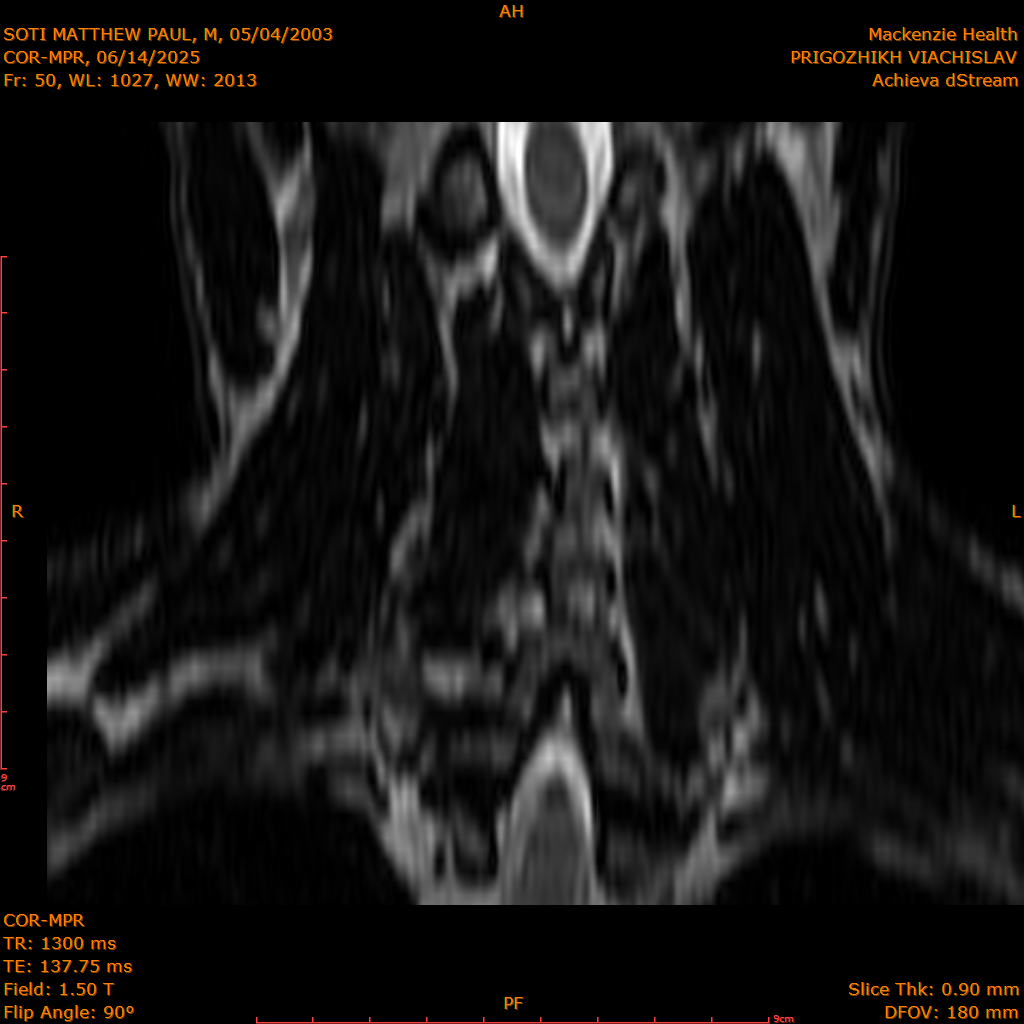 2025-06-14/COR-MPR/0051-IM136.png