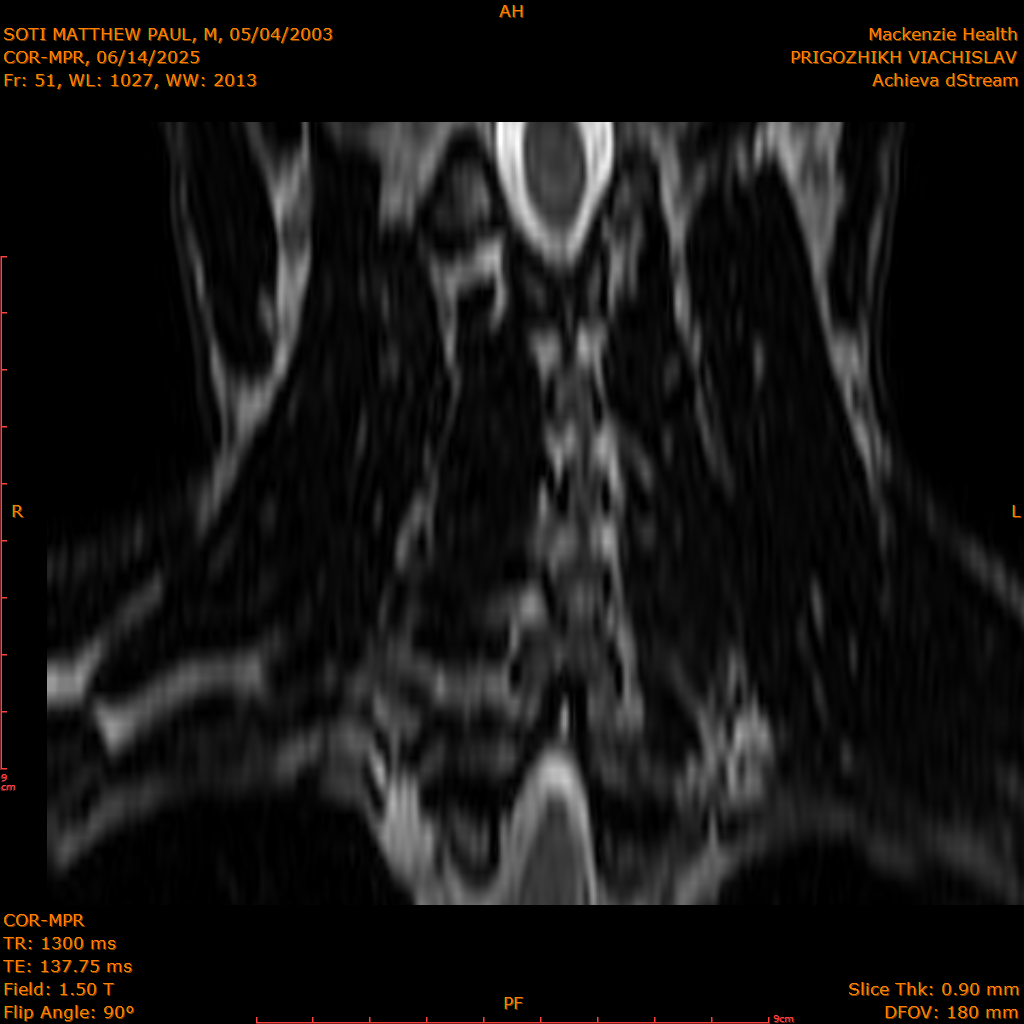 2025-06-14/COR-MPR/0052-IM137.png