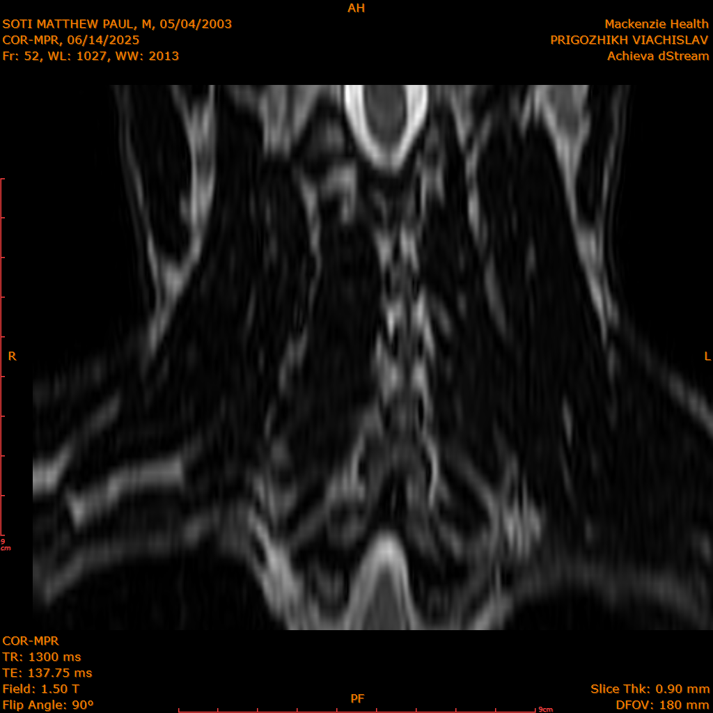 2025-06-14/COR-MPR/0053-IM138.png
