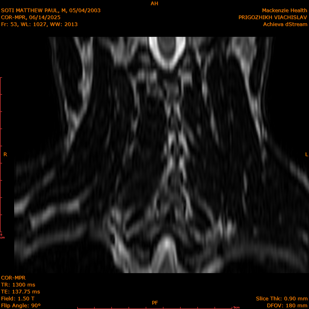 2025-06-14/COR-MPR/0054-IM139.png