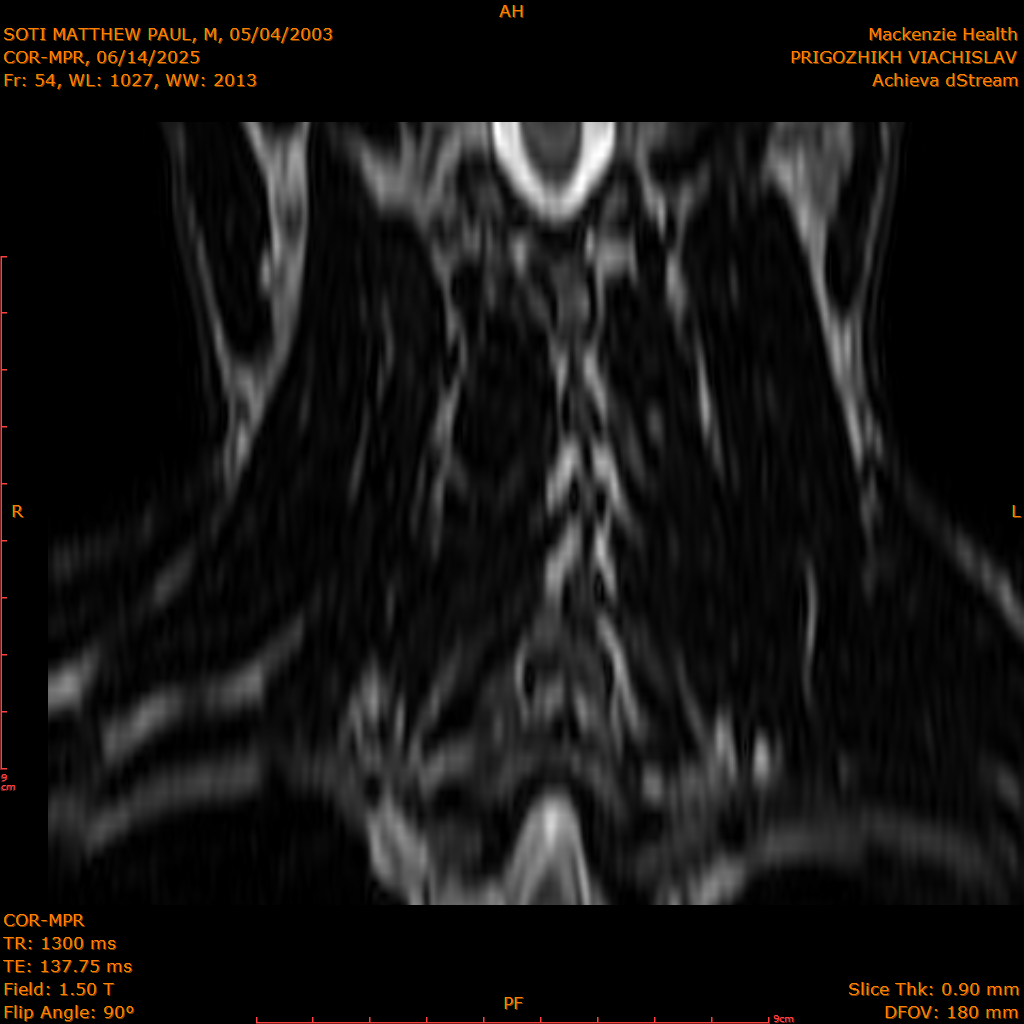 2025-06-14/COR-MPR/0055-IM140.png