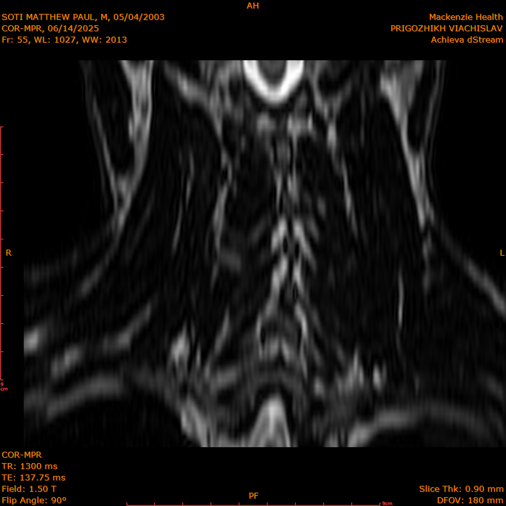 2025-06-14/COR-MPR/0056-IM141.png