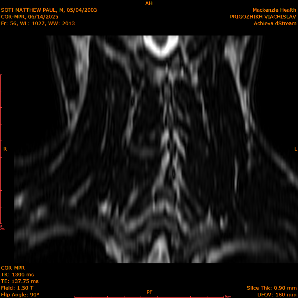 2025-06-14/COR-MPR/0057-IM142.png