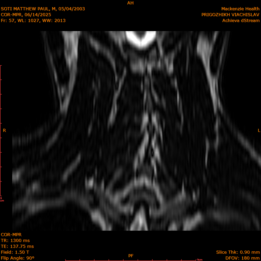 2025-06-14/COR-MPR/0058-IM143.png