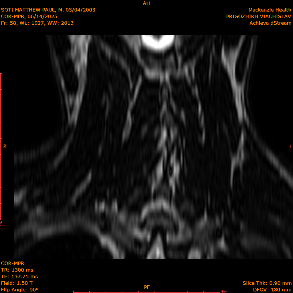 2025-06-14/COR-MPR/0059-IM144.png