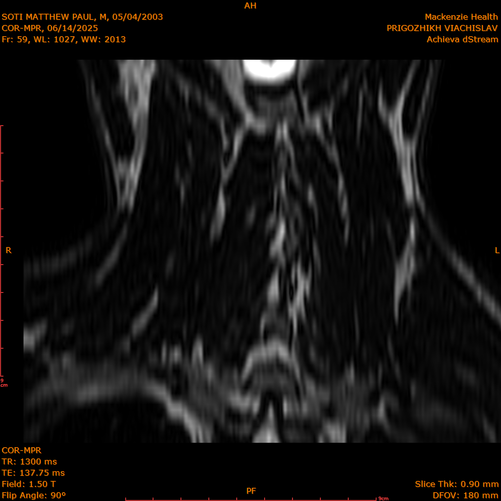 2025-06-14/COR-MPR/0060-IM145.png