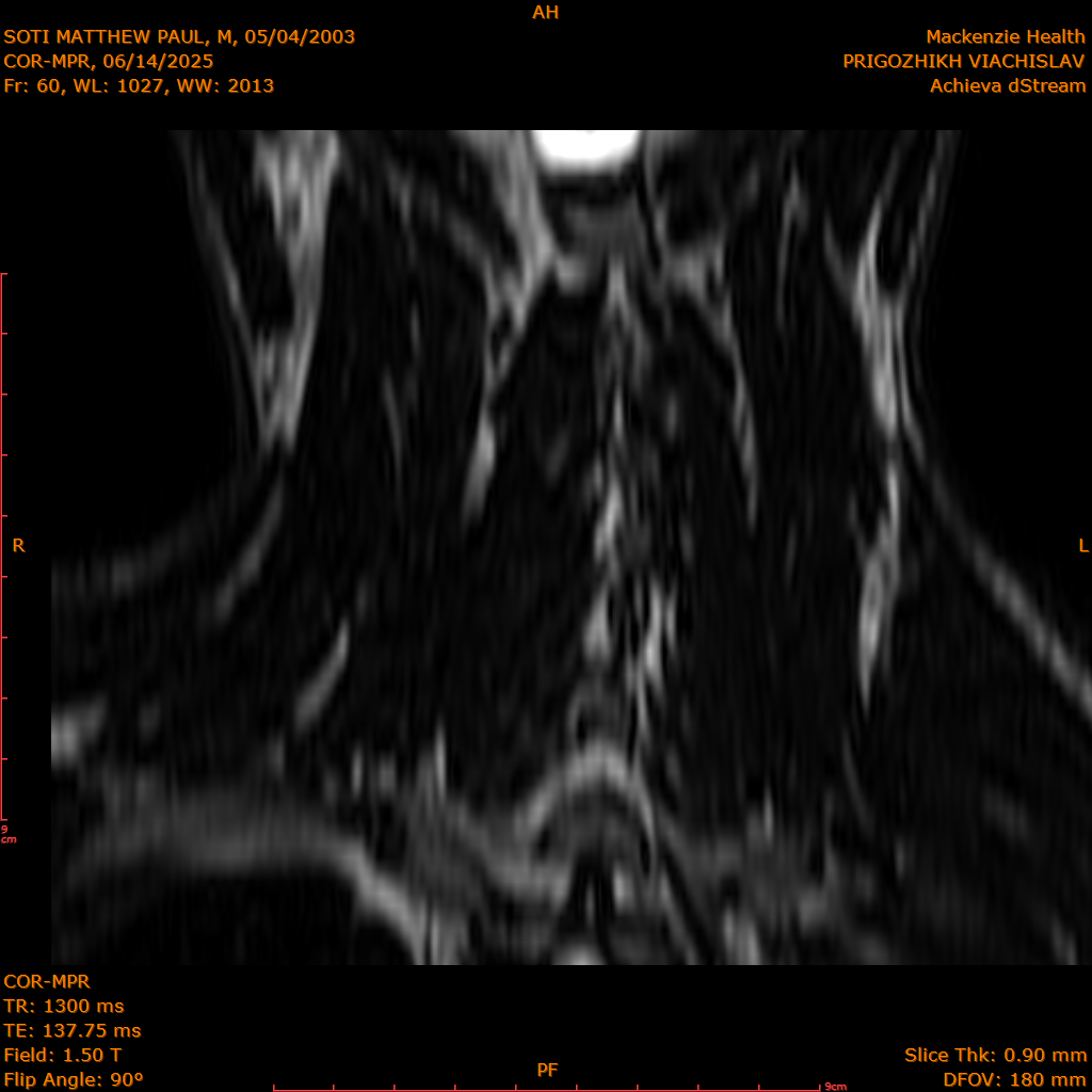 2025-06-14/COR-MPR/0061-IM146.png