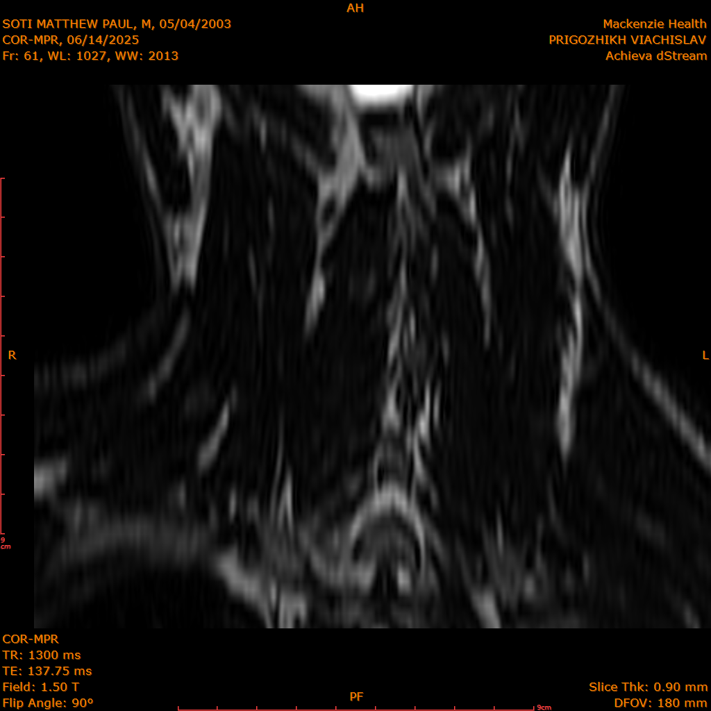 2025-06-14/COR-MPR/0062-IM147.png