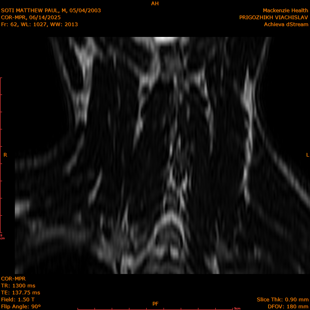 2025-06-14/COR-MPR/0063-IM148.png