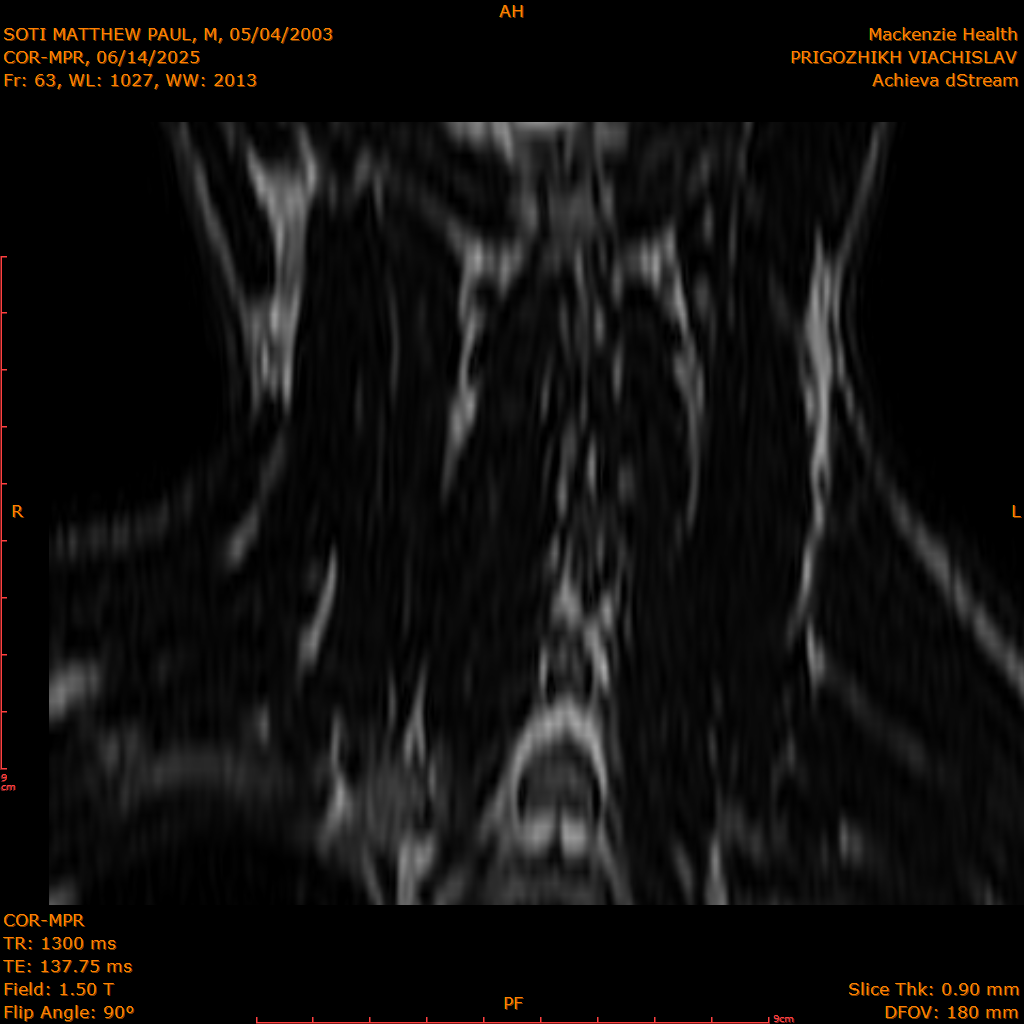 2025-06-14/COR-MPR/0064-IM149.png