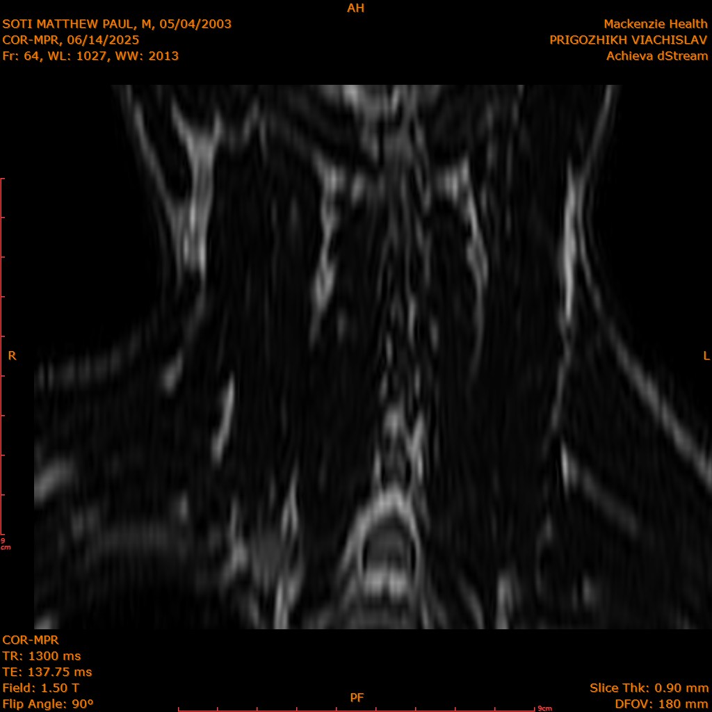 2025-06-14/COR-MPR/0065-IM150.png