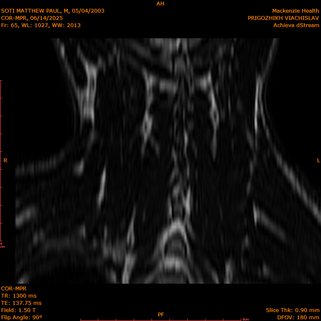 2025-06-14/COR-MPR/0066-IM151.png
