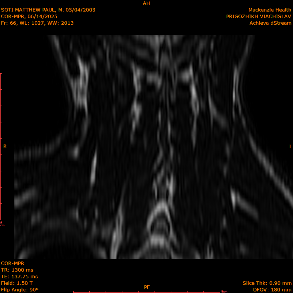 2025-06-14/COR-MPR/0067-IM152.png