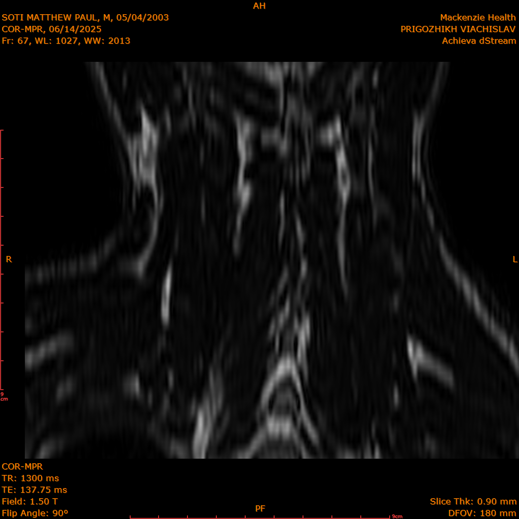 2025-06-14/COR-MPR/0068-IM153.png