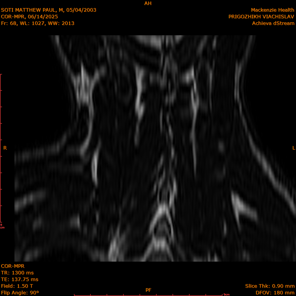 2025-06-14/COR-MPR/0069-IM154.png