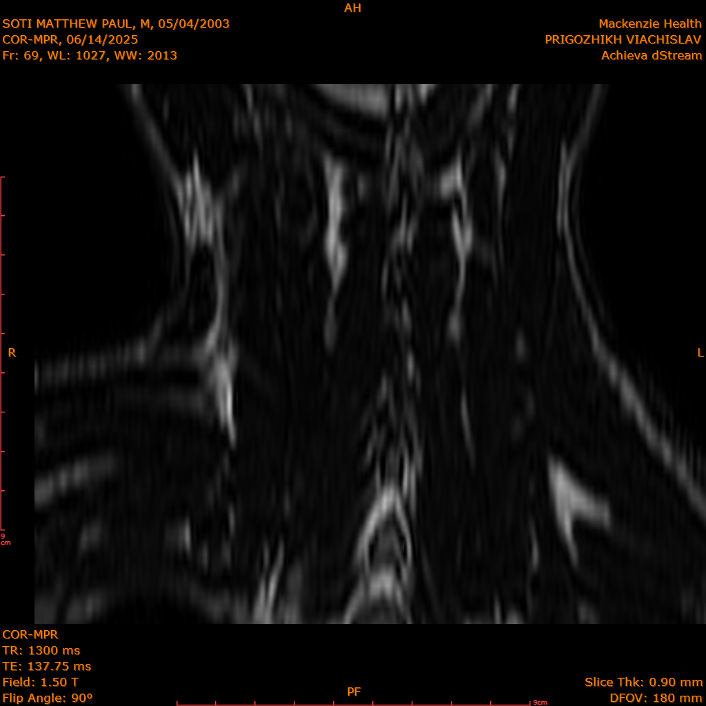 2025-06-14/COR-MPR/0070-IM155.png