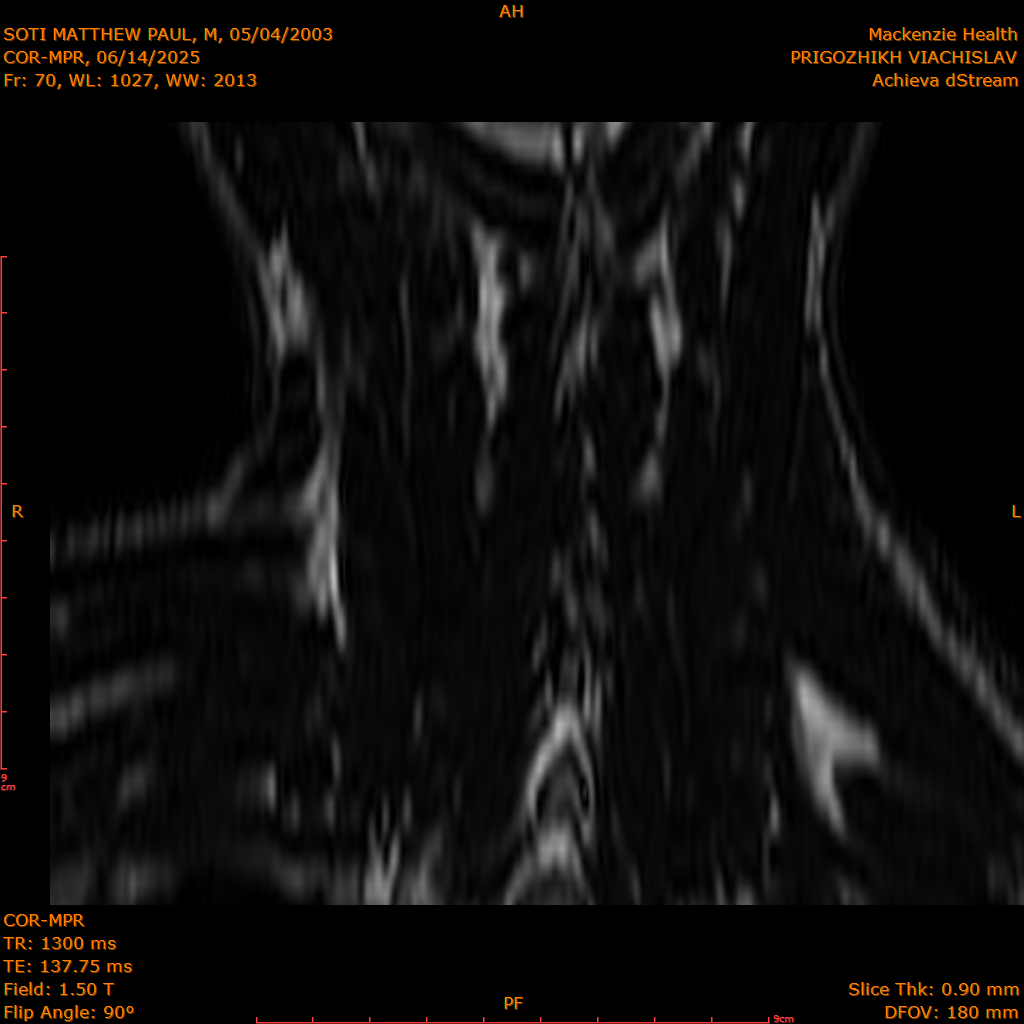 2025-06-14/COR-MPR/0071-IM156.png