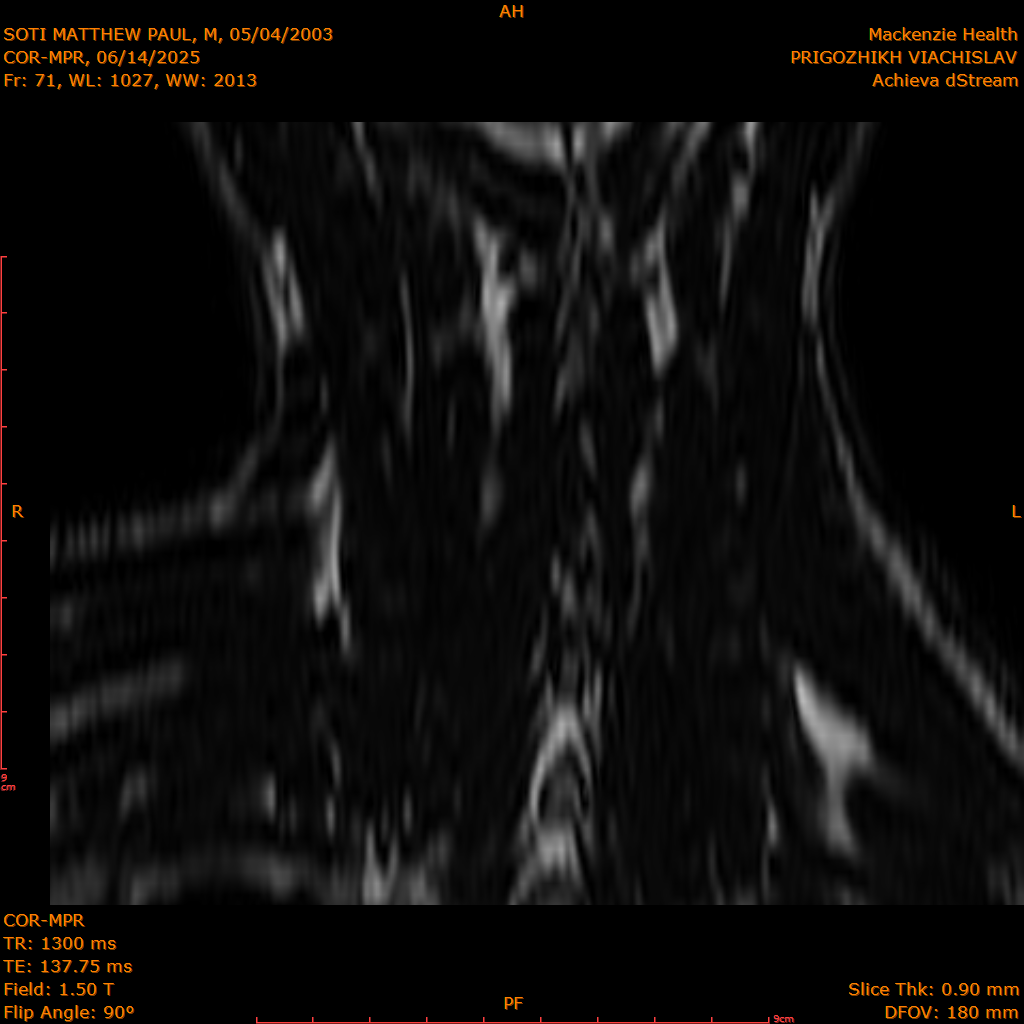 2025-06-14/COR-MPR/0072-IM157.png