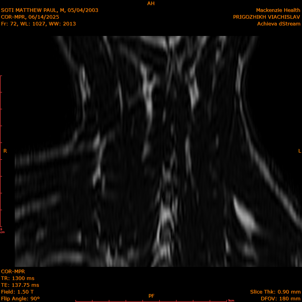 2025-06-14/COR-MPR/0073-IM158.png