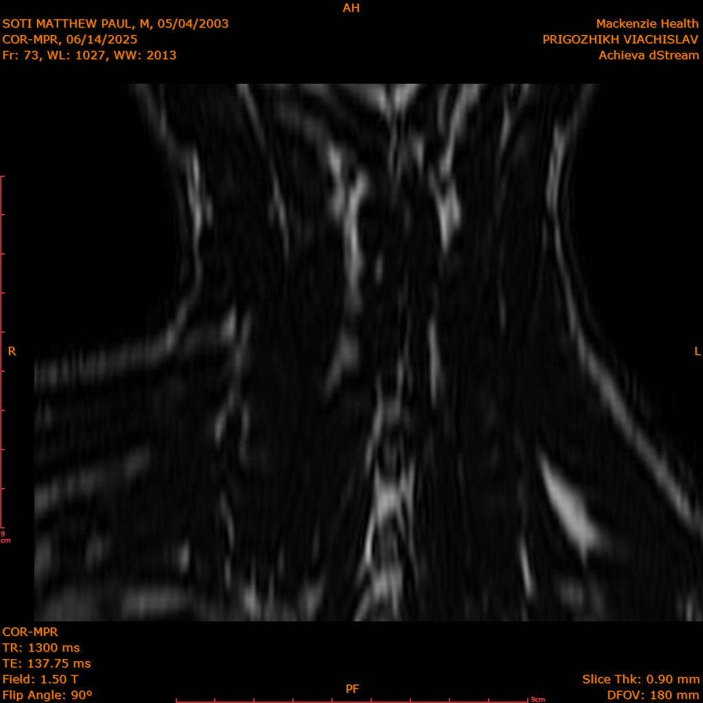 2025-06-14/COR-MPR/0074-IM159.png