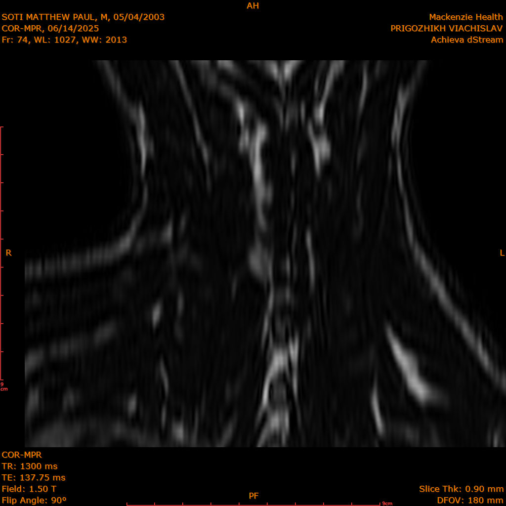 2025-06-14/COR-MPR/0075-IM160.png