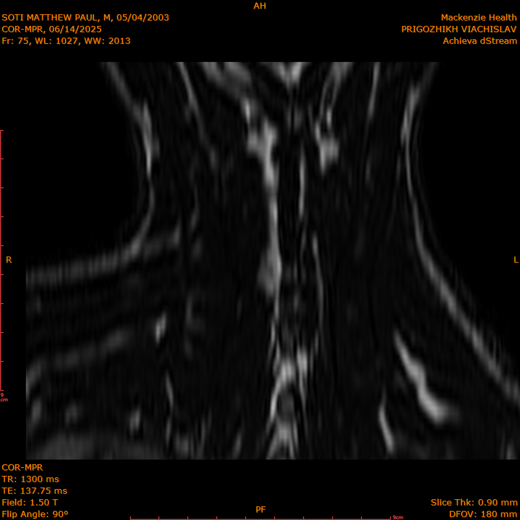 2025-06-14/COR-MPR/0076-IM161.png