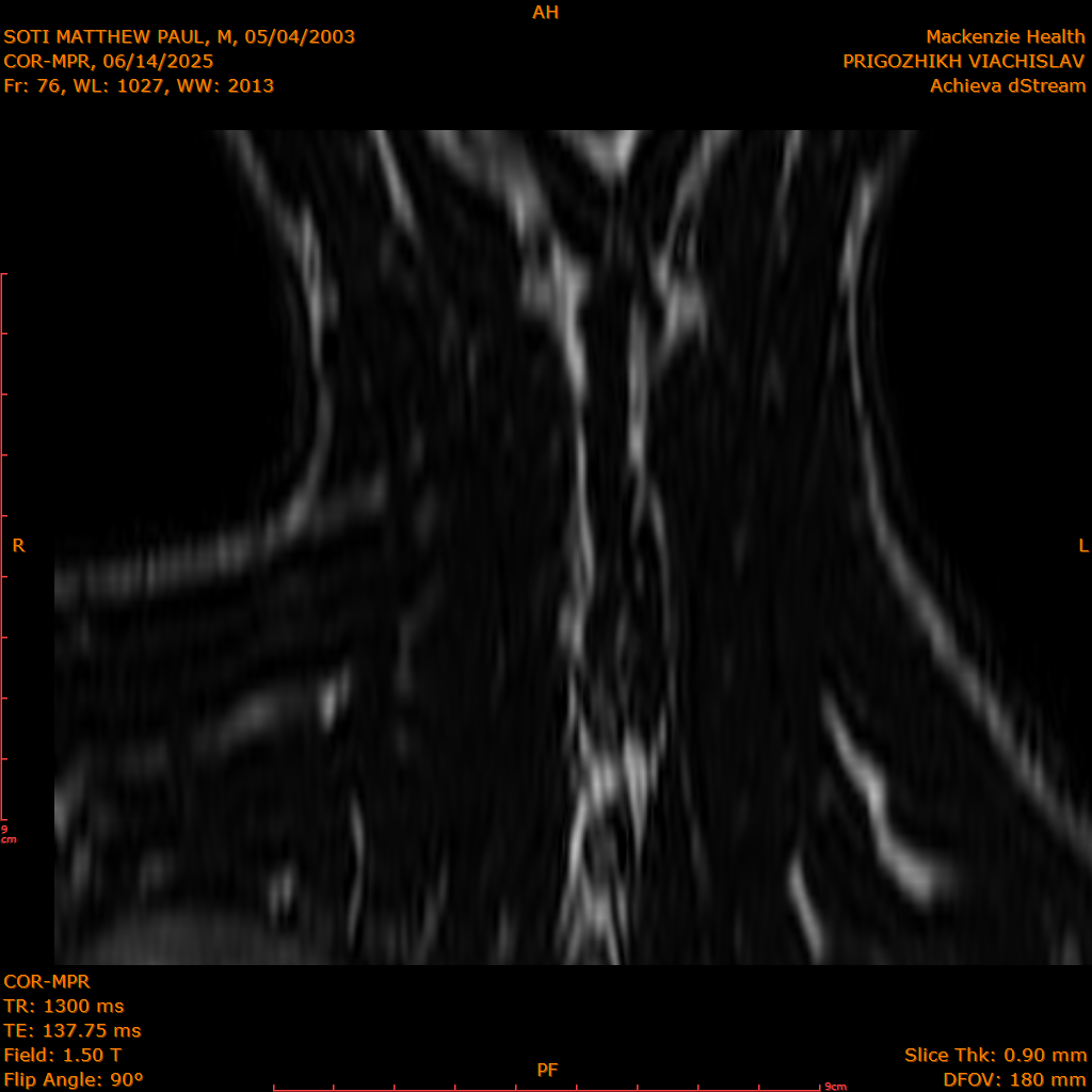 2025-06-14/COR-MPR/0077-IM162.png