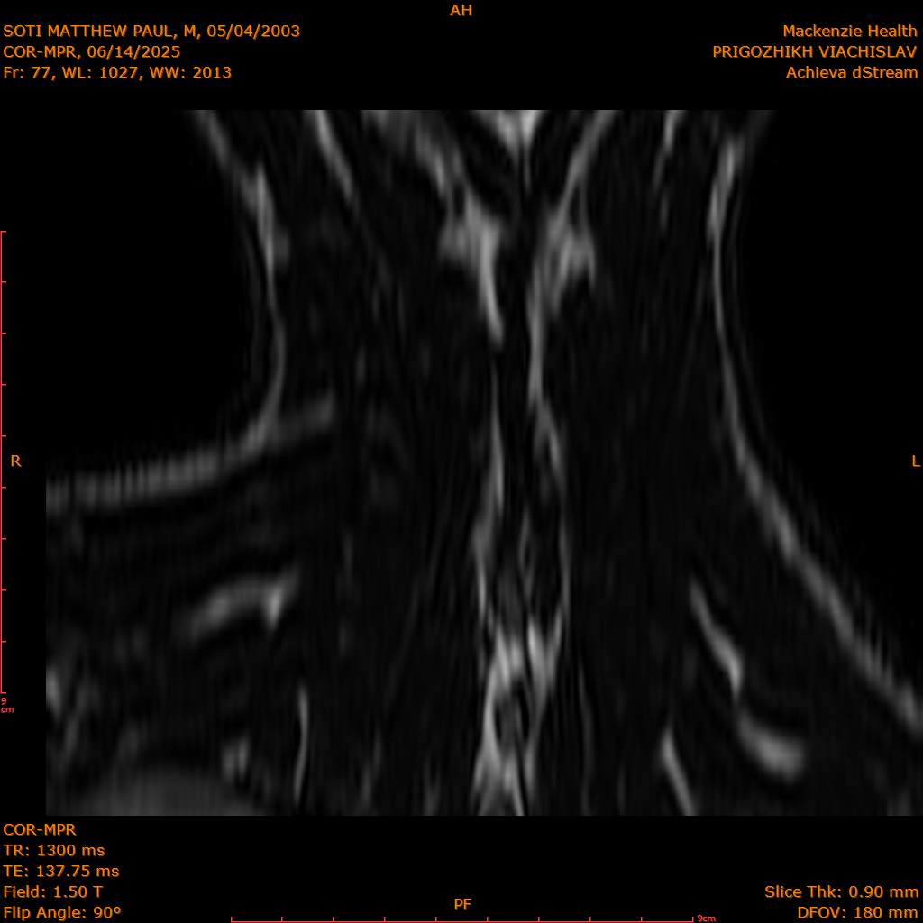 2025-06-14/COR-MPR/0078-IM163.png