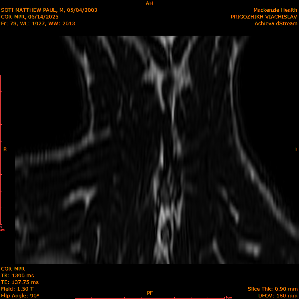 2025-06-14/COR-MPR/0079-IM164.png