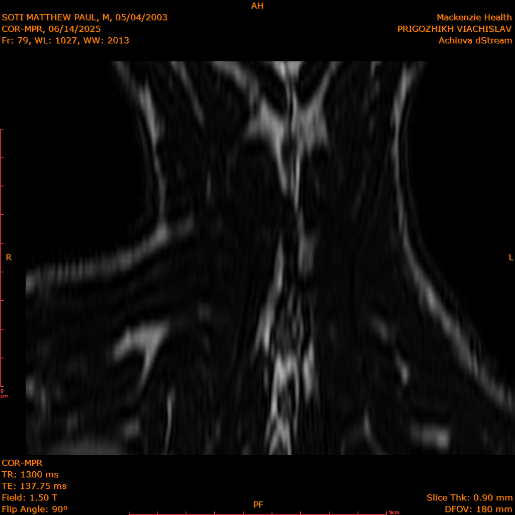 2025-06-14/COR-MPR/0080-IM165.png