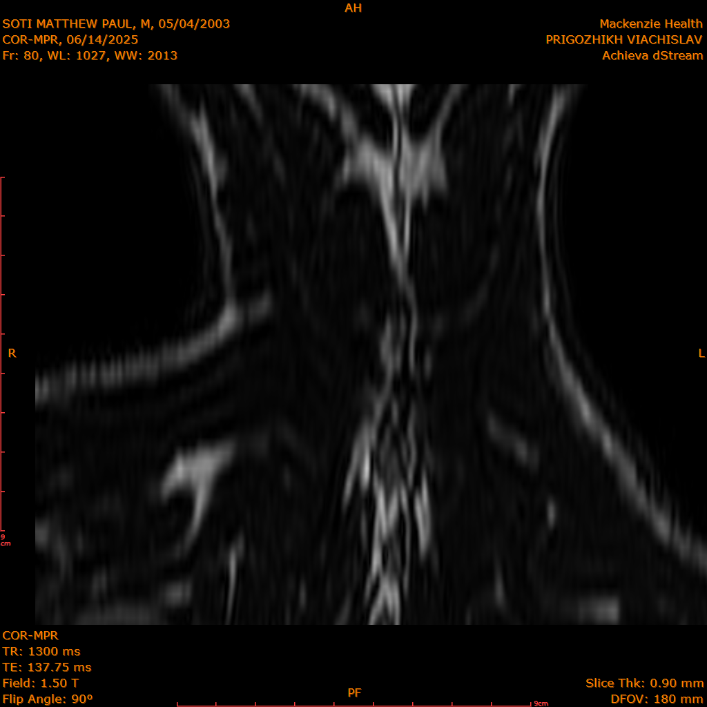 2025-06-14/COR-MPR/0081-IM166.png