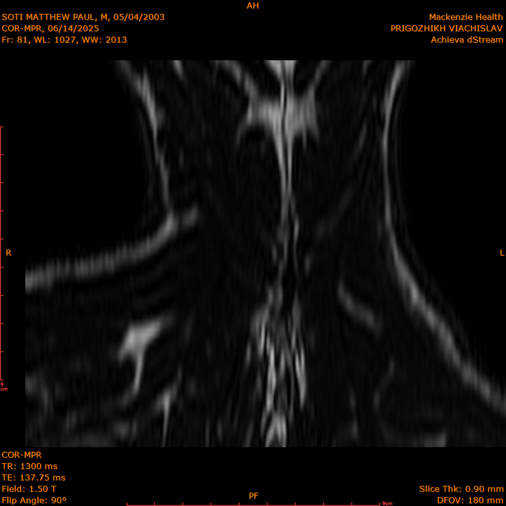 2025-06-14/COR-MPR/0082-IM167.png