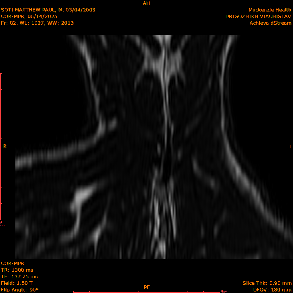 2025-06-14/COR-MPR/0083-IM168.png