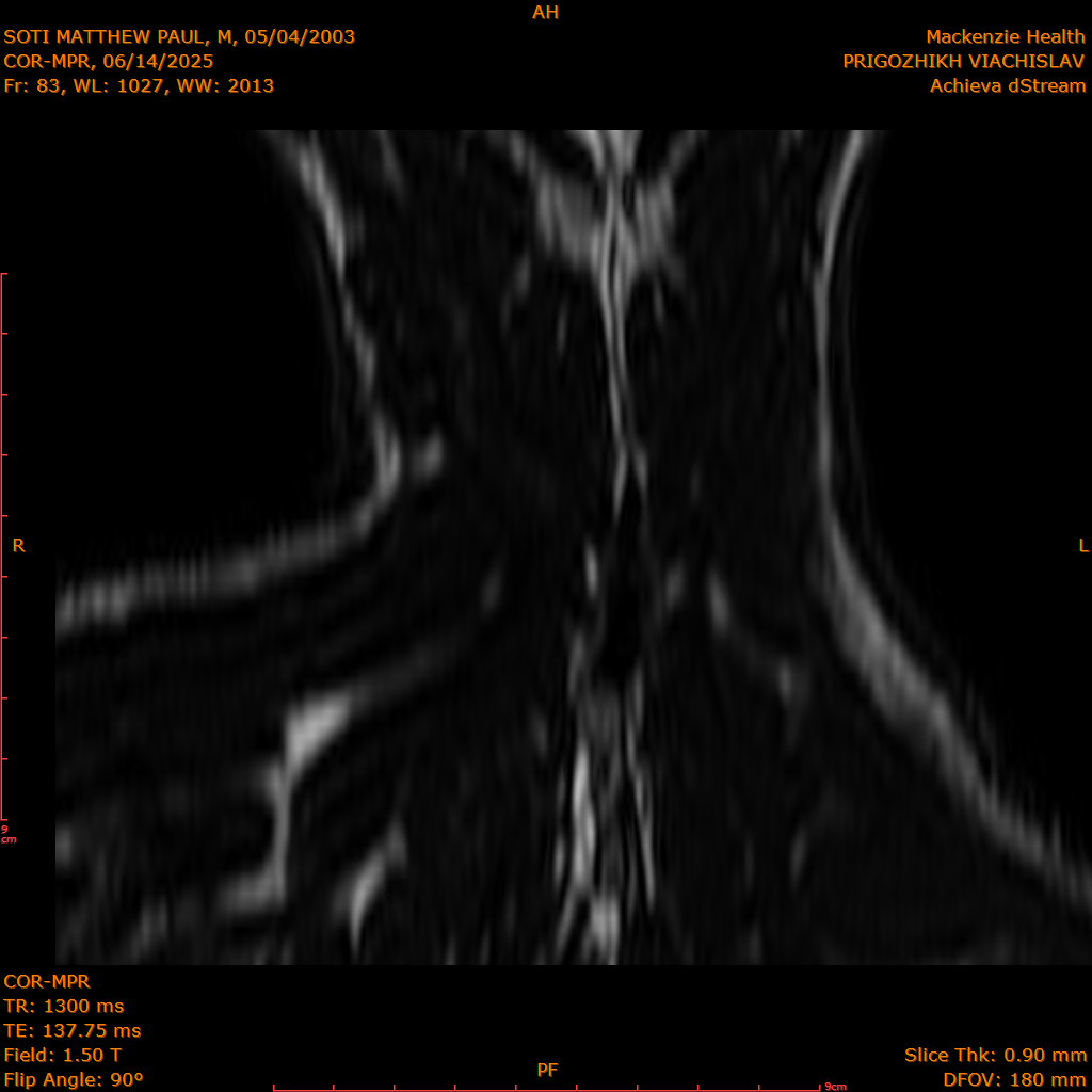 2025-06-14/COR-MPR/0084-IM169.png
