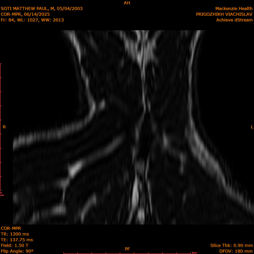 2025-06-14/COR-MPR/0085-IM170.png