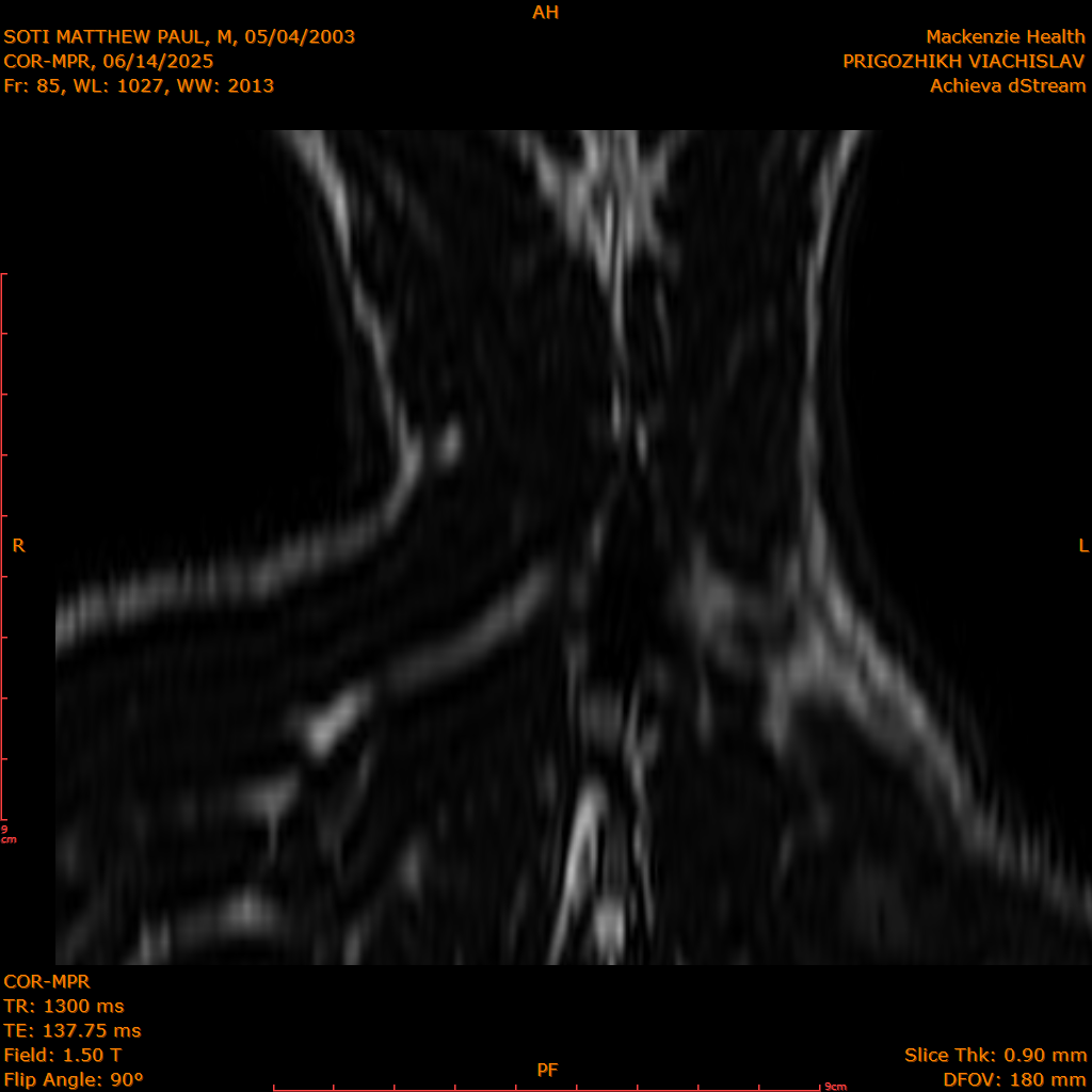 2025-06-14/COR-MPR/0086-IM171.png