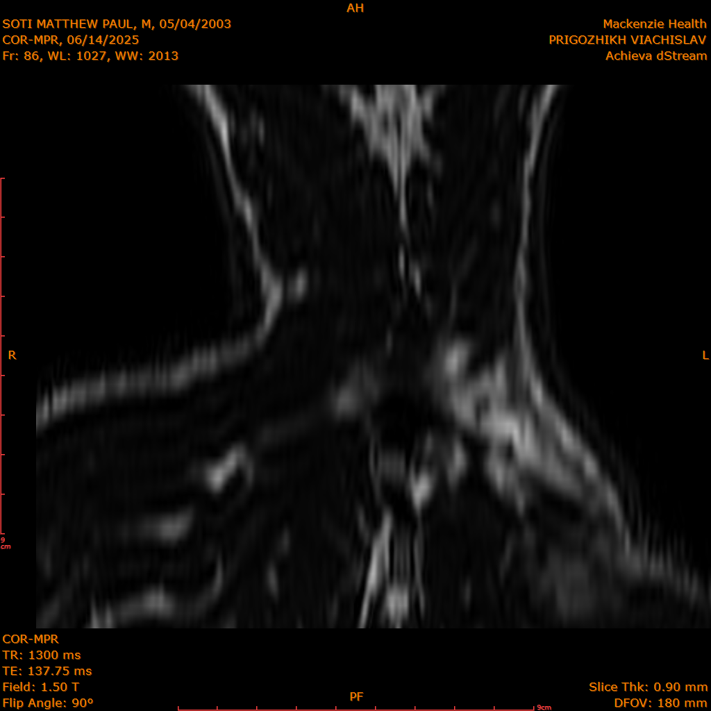 2025-06-14/COR-MPR/0087-IM172.png
