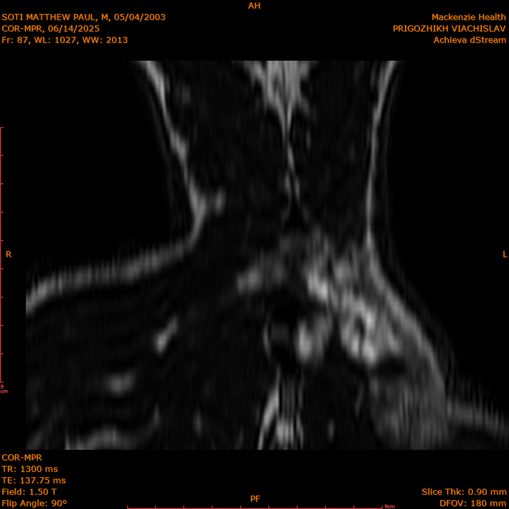2025-06-14/COR-MPR/0088-IM173.png