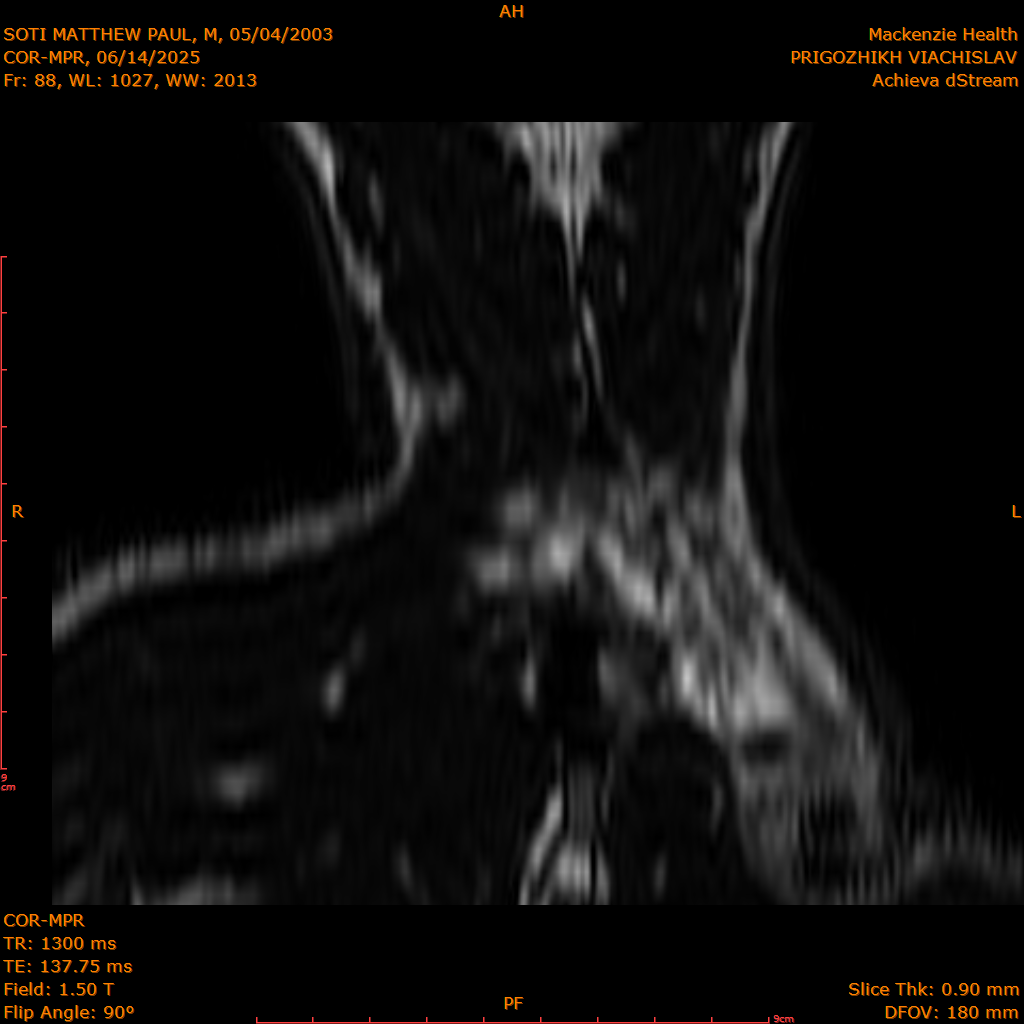 2025-06-14/COR-MPR/0089-IM174.png
