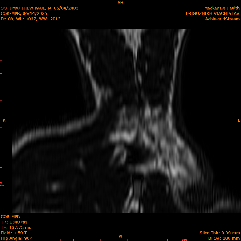 2025-06-14/COR-MPR/0090-IM175.png