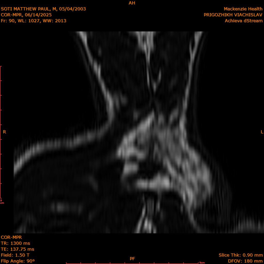 2025-06-14/COR-MPR/0091-IM176.png