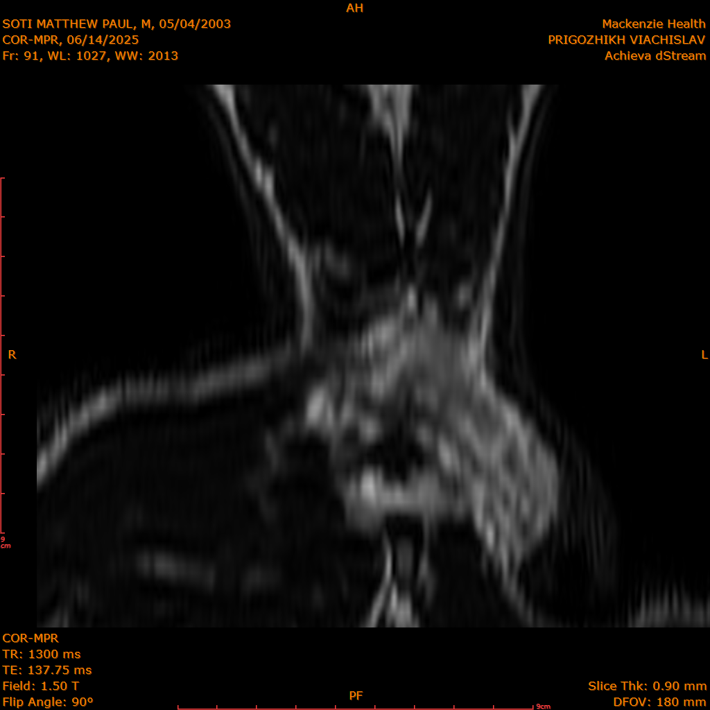 2025-06-14/COR-MPR/0092-IM177.png